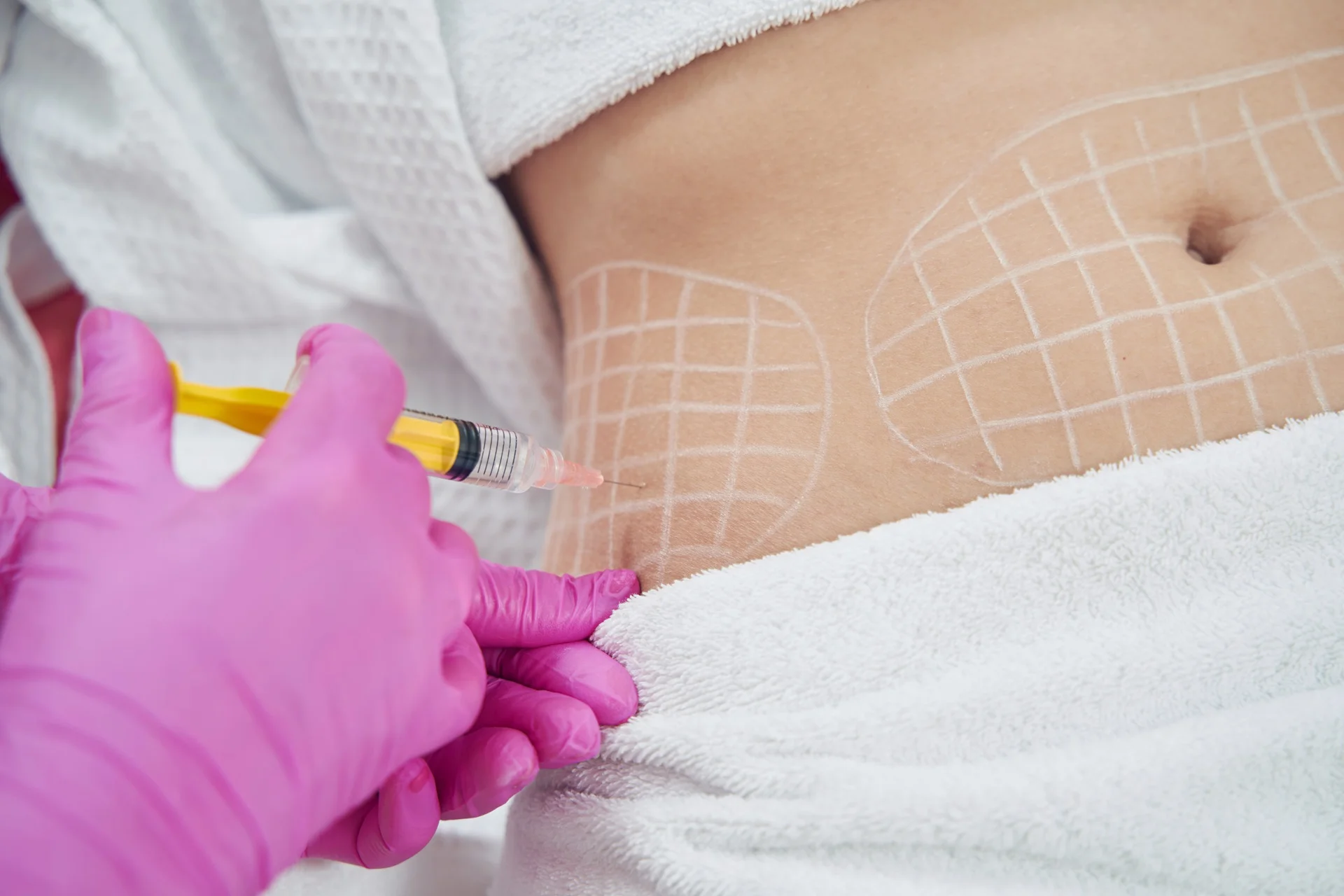 Fat Dissolving Injections in Savannah, GA at Anew Medical Spa