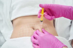 Fat-dissolving injections in savannah, GA by Anew Medical Spa